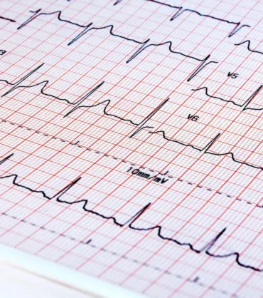 فحص كهرباء القلب الدكتور محمد الحجيري