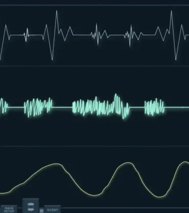 كهرباء القلب – اضطراب نظم القلب – خفقان القلب