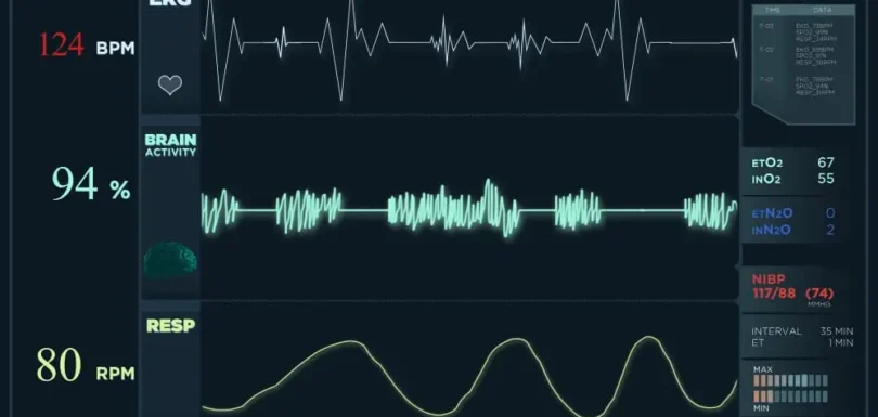 كهرباء القلب – اضطراب نظم القلب – خفقان القلب
