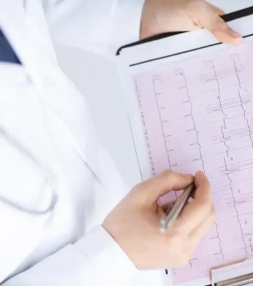 تخطيط القلب — ECG — فحص القلب