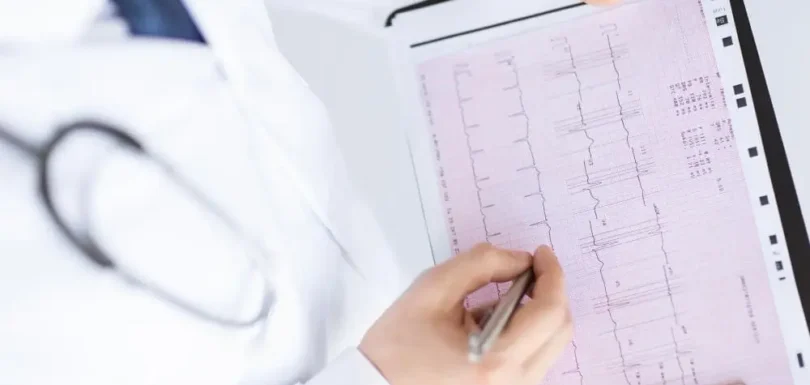 تخطيط القلب — ECG — فحص القلب