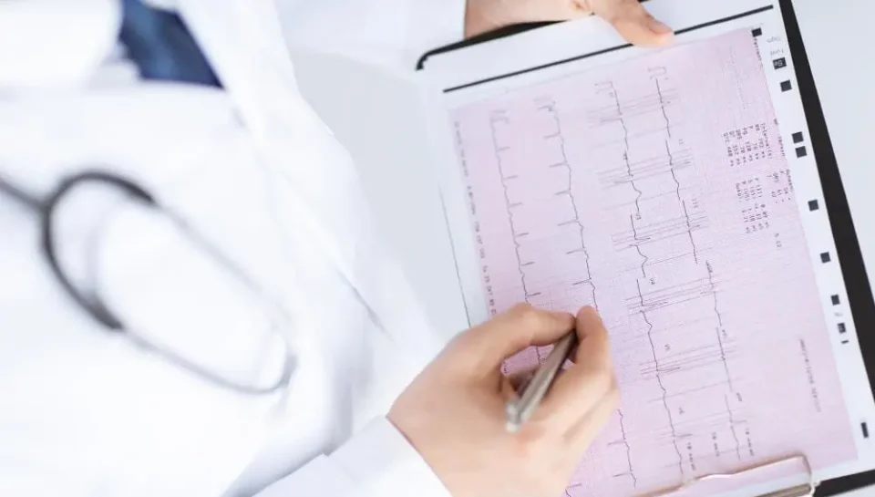تخطيط القلب — ECG — فحص القلب