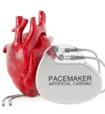 جهاز تنظيم ضربات القلب Pacemaker