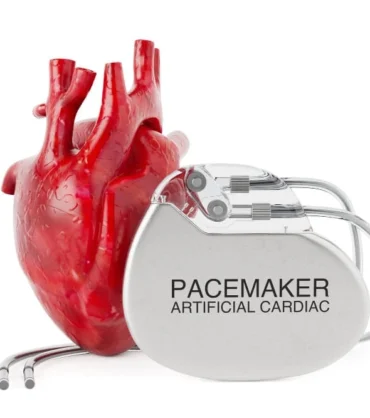 جهاز تنظيم ضربات القلب Pacemaker