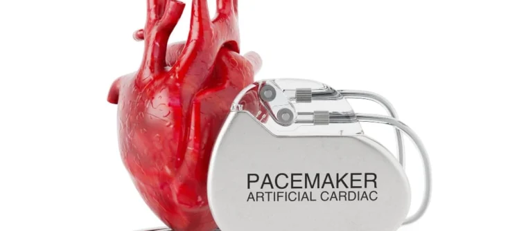 جهاز تنظيم ضربات القلب Pacemaker