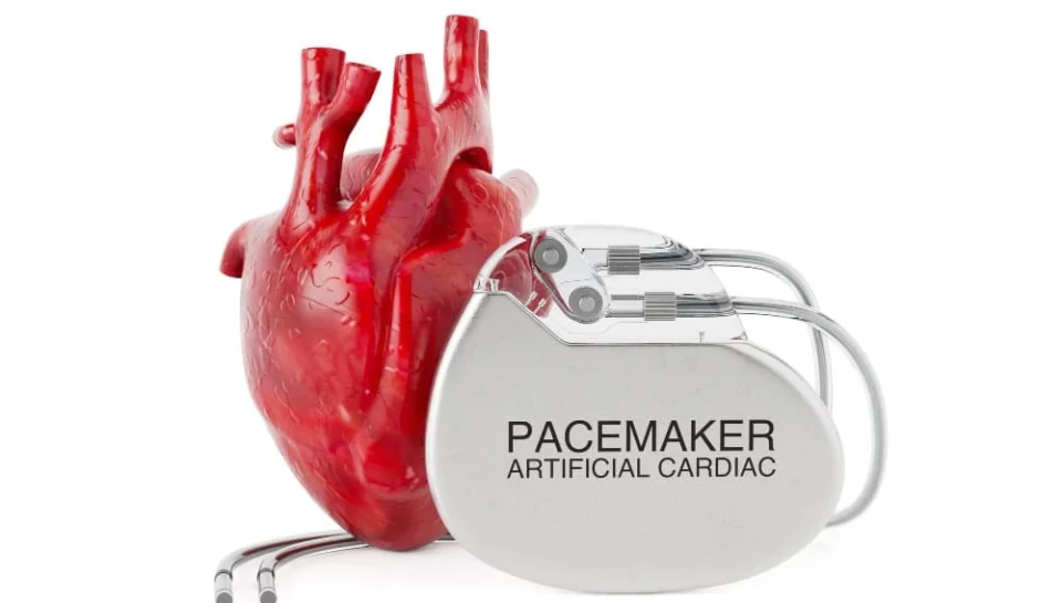 جهاز تنظيم ضربات القلب Pacemaker