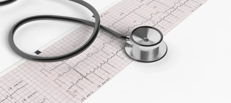 تخطيط القلب اضطرابات نظم القلب كهرباء القلب