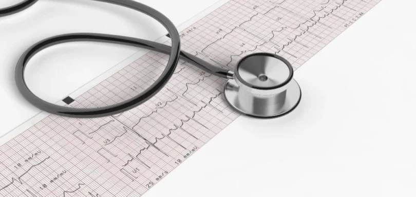 تخطيط القلب اضطرابات نظم القلب كهرباء القلب