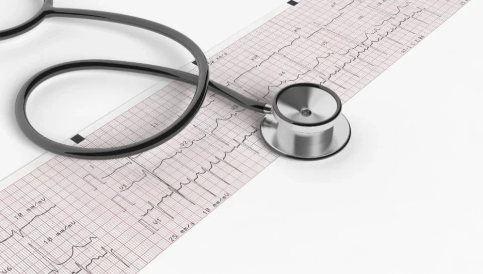 تخطيط القلب اضطرابات نظم القلب كهرباء القلب