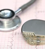 عملية تغيير بطارية جهاز تنظيم ضربات القلب استبدال بطارية جهاز تنظيم القلب جهاز تنظيم ضربات القلب تبديل بطارية Pacemaker